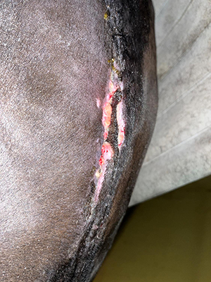 Cicatrizacion-deficiente-de-incision-01