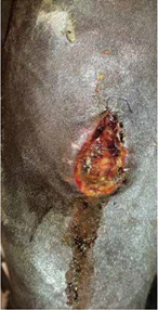 Herida-quirurgica-de-la-rodilla-01-Darasyl