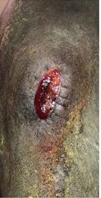 Herida-quirurgica-de-la-rodilla-02-Darasyl