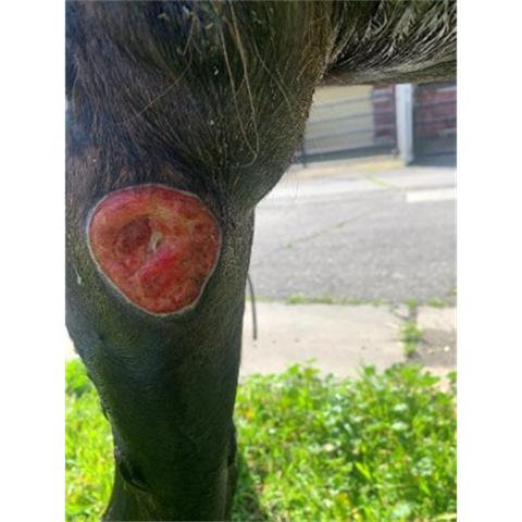 Vasculitis-cutanea-02-Darasyl