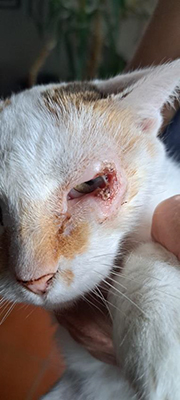 Tratamiento de un carcinoma de células basales-01 copia